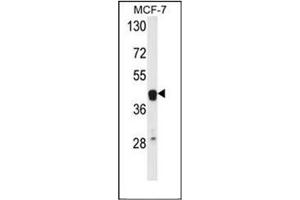 Western blot analysis of ETS2 Antibody (Center) in MCF-7 cell line lysates (35ug/lane). (ETS2 anticorps  (Middle Region))
