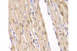 Immunohistochemistry of paraffin-embedded Rat heart using LIG3 Polyclonal Antibody at dilution of 1:100 (40x lens). (LIG3 anticorps)
