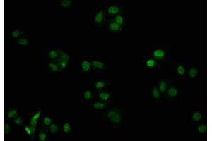 Immunofluorescence staining of HepG2 cells with ABIN7127421 at 1:32.