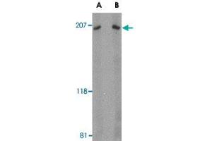 Western blot analysis of ARHGEF17 in Jurkat Cell lysate with ARHGEF17 polyclonal antibody  at (A) 1 and (B) 2 ug/mL . (ARHGEF17 anticorps  (Internal Region))