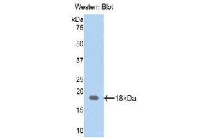 Western Blotting (WB) image for anti-serpin Peptidase Inhibitor, Clade A (Alpha-1 Antiproteinase, Antitrypsin), Member 6 (SERPINA6) (AA 280-405) antibody (ABIN1174372)
