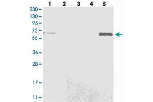 Western blot analysis of Lane 1: RT-4, Lane 2: U-251 MG, Lane 3: Human Plasma, Lane 4: Liver, Lane 5: Tonsil with C6orf190 polyclonal antibody . (THEMIS anticorps)