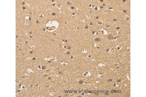 Immunohistochemistry of Human brain  using ALDH8A1 Polyclonal Antibody at dilution of 1:30 (ALDH8A1 anticorps)