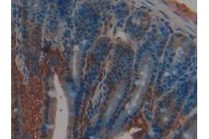 DAB staining on IHC-P; Samples: Rat Intestine Tissue