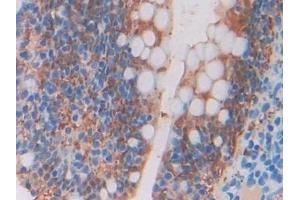 Detection of BLC in Rat Intestine Tissue using Polyclonal Antibody to B-Lymphocyte Chemoattractant (BLC)