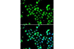 Immunofluorescence analysis of  cells using METTL13 antibody (ABIN6131842, ABIN6143755, ABIN6143757 and ABIN6216265). (METTL13 anticorps  (AA 430-699))