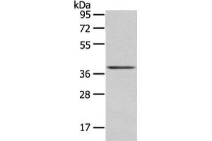 Gel: 8 % SDS-PAGE, Lysate: 40 μg, Lane: Mouse brain tissue, Primary antibody: ABIN7193059(WNT10A Antibody) at dilution 1/200 dilution, Secondary antibody: Goat anti rabbit IgG at 1/8000 dilution, Exposure time: 10 seconds