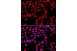Immunofluorescence analysis of A549 cell using ARHGEF9 antibody. (Arhgef9 anticorps)