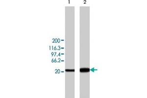 Western blot analysis of min6 cells overexpressing rat Camk2d, using Camk2d polyclonal antibody . (CAMK2D anticorps)