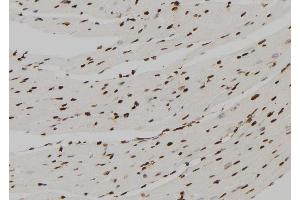 ABIN6277568 at 1/100 staining Mouse heart tissue by IHC-P.