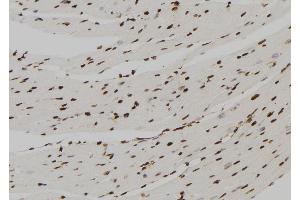 ABIN6277568 at 1/100 staining Mouse heart tissue by IHC-P. (FBP1 anticorps  (Internal Region))