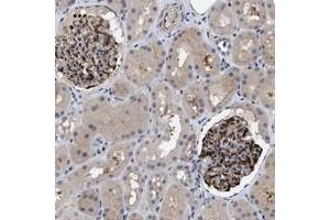 Immunohistochemical staining of human kidney with IL17RE polyclonal antibody  shows strong cytoplasmic and membranous positivity in glomeruli at 1:50-1:200 dilution. (IL17RE anticorps)