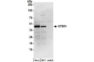 Western Blotting (WB) image for anti-Starch Binding Domain 1 (STBD1) (AA 75-125) antibody (ABIN7450783)