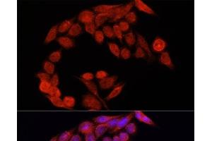 Immunofluorescence analysis of HeLa cells using NRF2 Polyclonal Antibody at dilution of 1:100. (NRF2 anticorps)