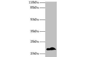 Western blot All lanes: NDUFB5 antibody at 2 μg/mL + U251 whole cell lysate Secondary Goat polyclonal to rabbit IgG at 1/10000 dilution Predicted band size: 22, 16 kDa Observed band size: 22 kDa
