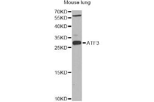 Western blot analysis of extracts of mouse lung, using ATF3 Antibody (ABIN1871129) at 1:1000 dilution. (ATF3 anticorps)