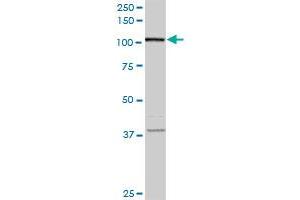 FLJ20097 monoclonal antibody (M01A), clone 2D11. (Syndetin/VPS50 anticorps  (AA 862-964))