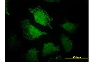 Immunofluorescence of monoclonal antibody to EHD3 on HeLa cell. (EHD3 anticorps  (AA 357-406))