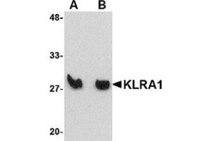 Western blot analysis of KLRA1 in mouse spleen tissue lysate with KLRA1 antibody at (A) 1 μg/ml and (B) 2 μg/ml. (KLRA1 anticorps  (Center))
