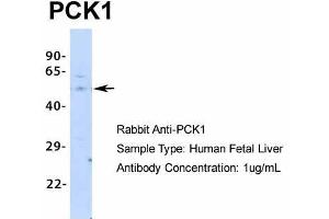 Host: Rabbit  Target Name: PCK1  Sample Tissue: Human Fetal Liver  Antibody Dilution: 1. (PCK1 anticorps  (Middle Region))