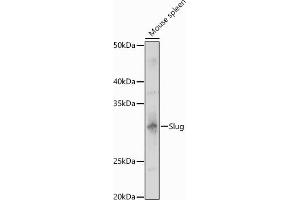 Western blot analysis of extracts of Mouse spleen, using Slug antibody (ABIN3021317, ABIN3021318, ABIN3021319 and ABIN6214866) at 1:1000 dilution. (SLUG anticorps  (AA 89-268))