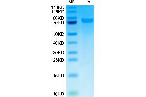 TNC Protein (AA 23-621) (His tag)