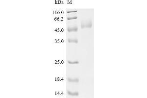 (Tris-Glycine gel) Discontinuous SDS-PAGE (reduced) with 5 % enrichment gel and 15 % separation gel.