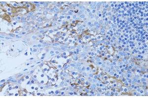 Immunohistochemistry of paraffin-embedded Human tonsil using HADH Polyclonal Antibody at dilution of 1:100 (40x lens). (HADH anticorps)