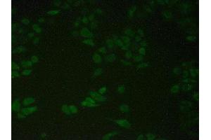 Detection of PDIA4 in Human Hela Cells using Polyclonal Antibody to Protein Disulfide Isomerase A4 (PDIA4)