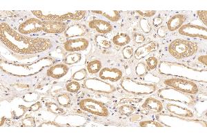 Detection of ACO1 in Human Kidney Tissue using Polyclonal Antibody to Aconitase 1 (ACO1)