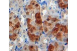 IHC-P analysis of Kidney tissue, with DAB staining. (MMP24 anticorps  (AA 429-642))