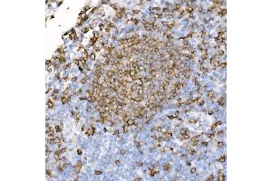 Immunohistochemistry of paraffin-embedded human tonsil using CD20 antibody (ABIN7268472) at dilution of 1:100 (40x lens). (CD20 anticorps)