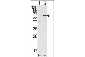 Western blot analysis of DOK1 (arrow) using DOK1 Antibody (N-term) (ABIN392070 and ABIN2841833).