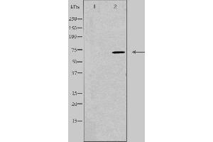 Western blot analysis of extracts from Jurkat cells, using DYR1B antibody.