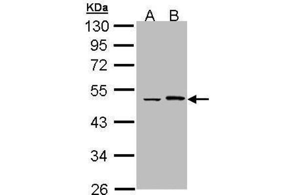 EPHX1 anticorps
