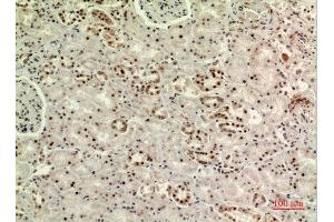Immunohistochemistry (IHC) analysis of paraffin-embedded Human Kidney, antibody was diluted at 1:100.