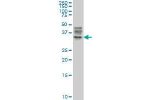 ATG3 monoclonal antibody (M06), clone 1F7 Western Blot analysis of ATG3 expression in Jurkat . (ATG3 anticorps  (AA 1-100))