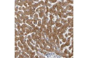 Immunohistochemical staining of human liver with GAB3 polyclonal antibody  shows moderate cytoplasmic positivity in hepatocytes.
