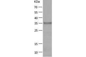Western Blotting (WB) image for SH3-Domain GRB2-Like Endophilin B1 (SH3GLB1) (AA 1-365) protein (His-IF2DI Tag) (ABIN7125766)