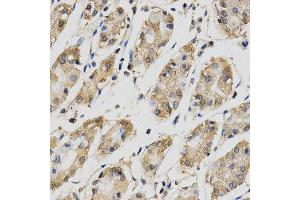 Immunohistochemistry (IHC) image for anti-Cell Division Cycle 34 (CDC34) antibody (ABIN1876645) (CDC34 anticorps)