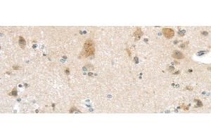 Immunohistochemistry of paraffin-embedded Human brain tissue using VSIG10 Polyclonal Antibody at dilution 1:45 (VSIG10 anticorps)