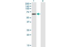 Western Blot analysis of LIPG expression in transfected 293T cell line by LIPG monoclonal antibody (M01), clone 4A9. (LIPG anticorps  (AA 21-500))