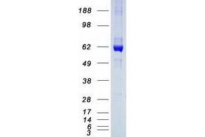 Validation with Western Blot