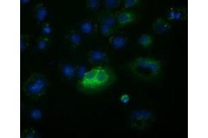 Anti-FSHB mouse monoclonal antibody (ABIN2453052) immunofluorescent staining of COS7 cells transiently transfected by pCMV6-ENTRY FSHB (RC214616). (FSHB anticorps)