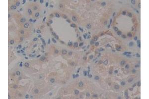 DAB staining on IHC-P; Samples: Human Kidney Tissue (STAT2 anticorps  (AA 616-849))