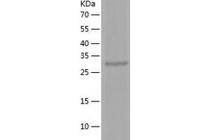 Western Blotting (WB) image for Decorin (DCN) (AA 35-354) protein (His tag) (ABIN7122611) (Decorin Protein (DCN) (AA 35-354) (His tag))