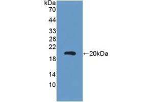 Detection of Recombinant CEA, Mouse using Polyclonal Antibody to Carcinoembryonic Antigen (CEA) (CEA anticorps  (AA 544-771))