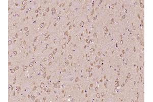 Paraformaldehyde-fixed, paraffin embedded Mouse brain Antigen retrieval by boiling in sodium citrate buffer (pH6.