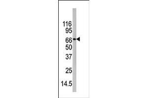 Image no. 1 for anti-Peptidyl Arginine Deiminase, Type IV (PADI4) (C-Term) antibody (ABIN357799)