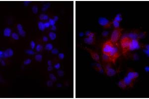Human hepatocellular carcinoma cell line Hep G2 was stained with Rabbit Anti-Human DR5-UNLB and DAPI. (Âne anti-Lapin IgG (Heavy & Light Chain) Anticorps (HRP) - Preadsorbed)